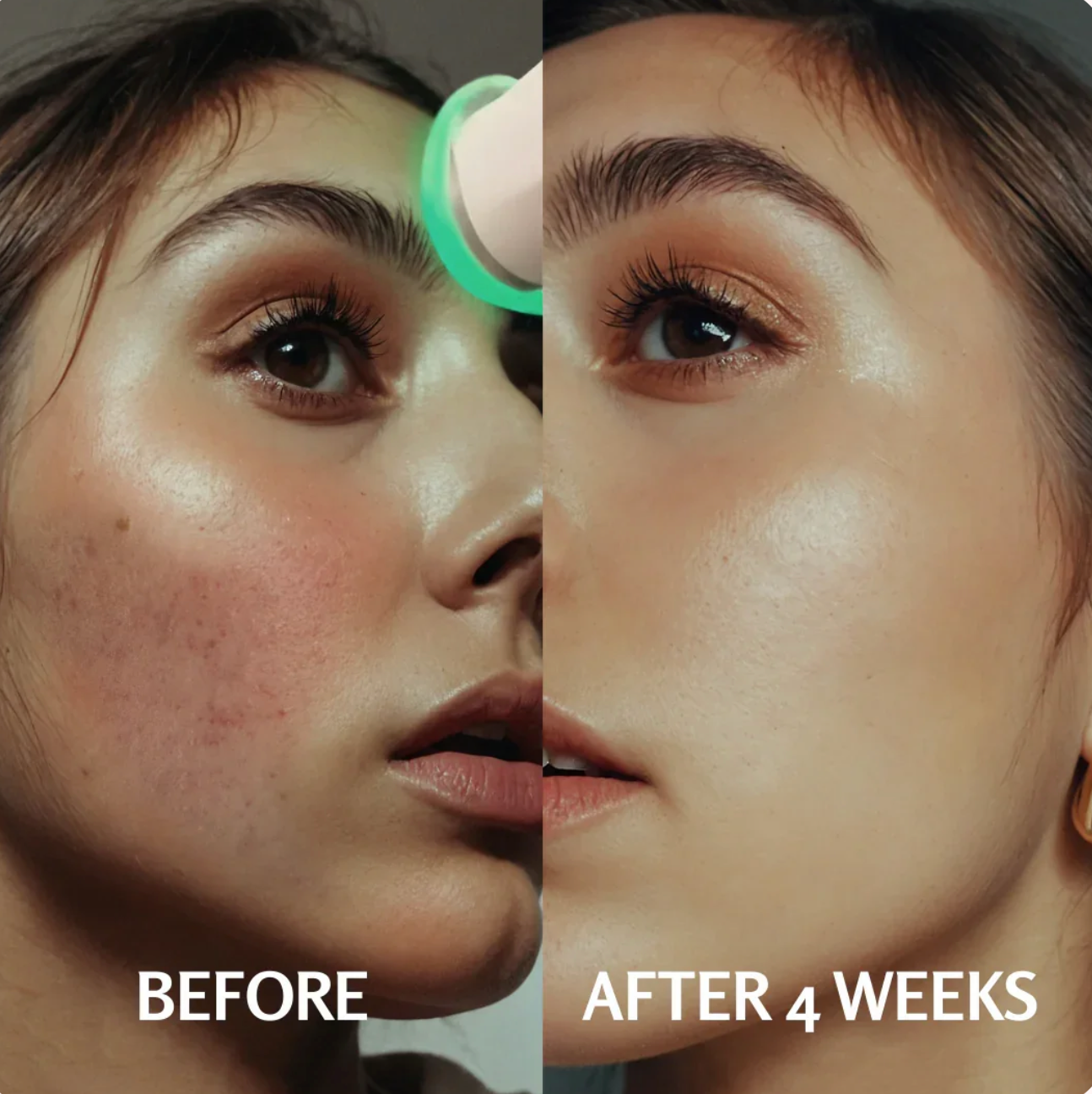 PureO2 - Bioactive Delivery MicrOxygenation